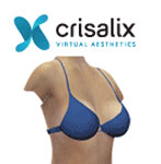 Crisalix -Plastic Surgery Sydney -Pure Aesthetics