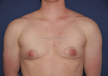 chest